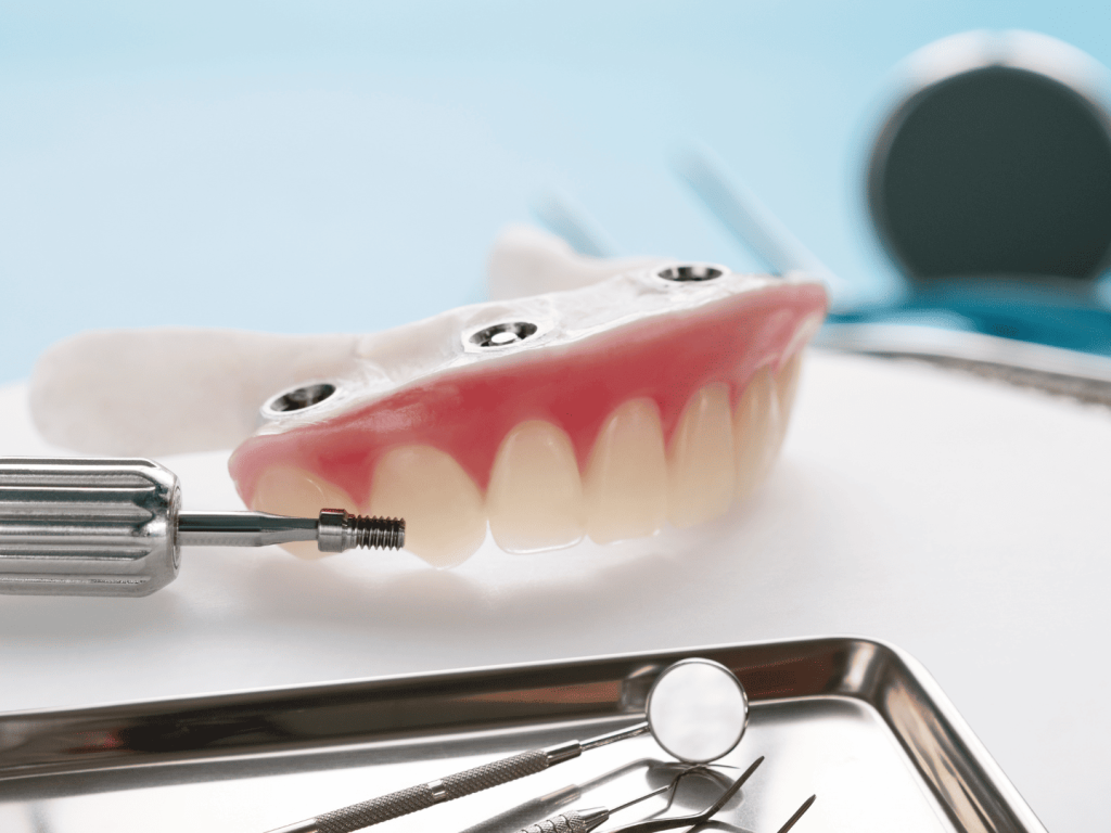 高雄All-on-4植牙-全口重建推薦