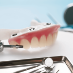 高雄All-on-4植牙-全口重建推薦