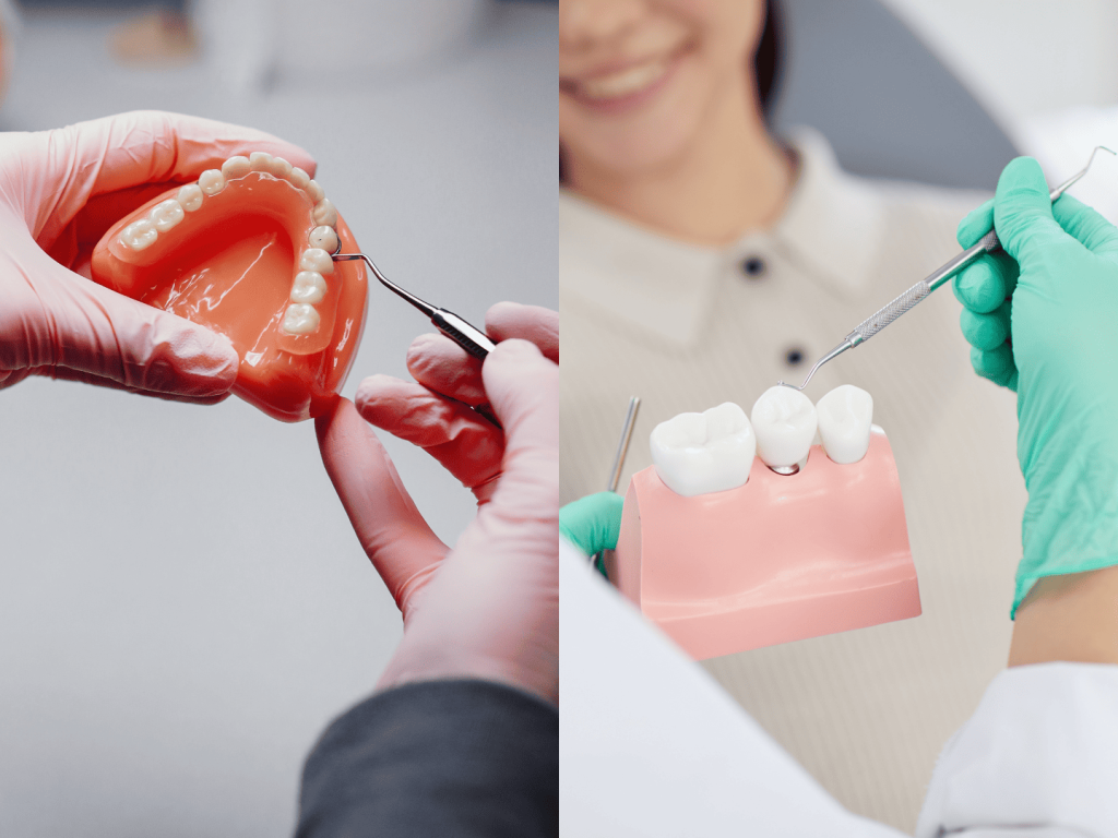 高雄植牙推薦-假牙與植牙