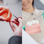 高雄植牙推薦-假牙與植牙