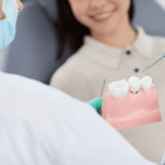 高雄植牙推薦-植牙