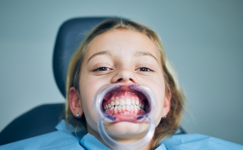 台中兒童矯正-牙齒矯正